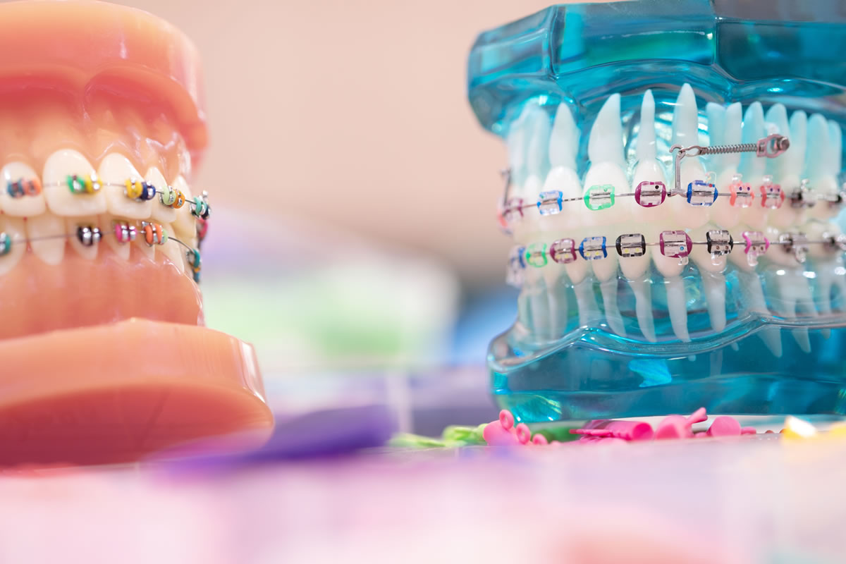 632f147142ee5-orthodontic.jpg