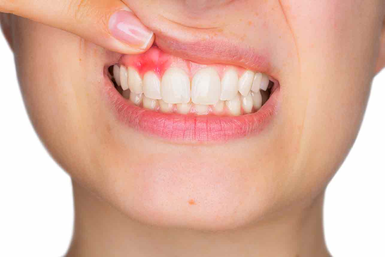 632f147143905-Gum966522.jpg