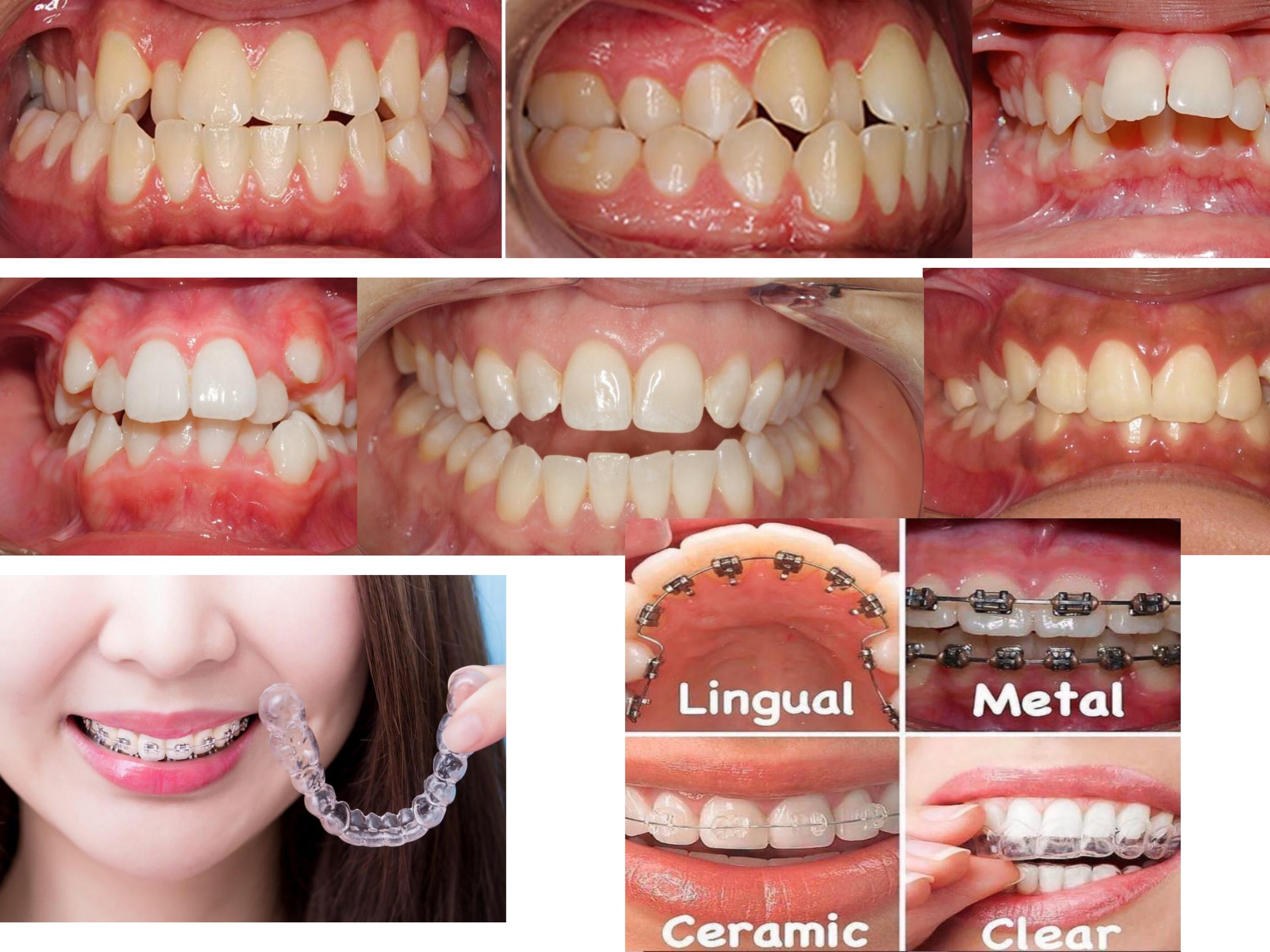 6347f9441ad97-p_card_ortho.jpg
