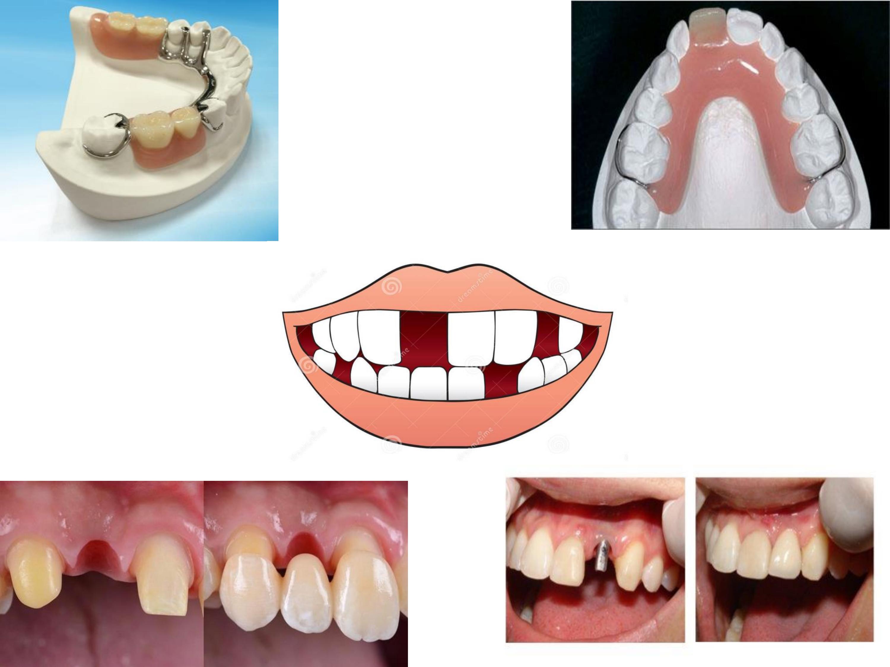 634d6369f0b3d-collage_ppt.jpg