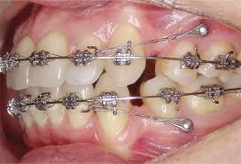 72640-ORTHODONTICS.jpeg